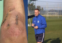 Cendrim Kameraj: Vom strahlenden Nachwuchstalent zum dreifachen Kreuzbandriss-Patienten